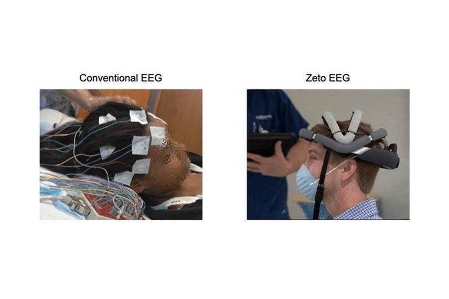 Zeto EEG